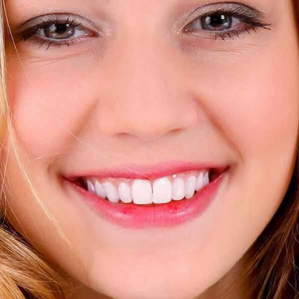 Audica Care Results